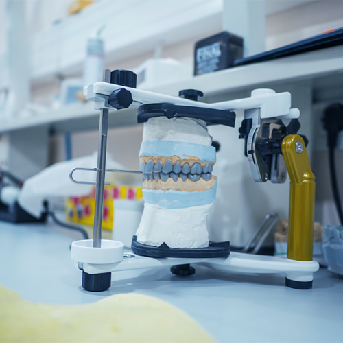 Check up-ortodontico adulti con un an articolatore dentale con un modello di denti in gesso è posizionato su un banco di lavoro del laboratorio, circondato da vari strumenti e attrezzature dentali utilizzati per creare soluzioni dentali per adulti sullo sfondo.