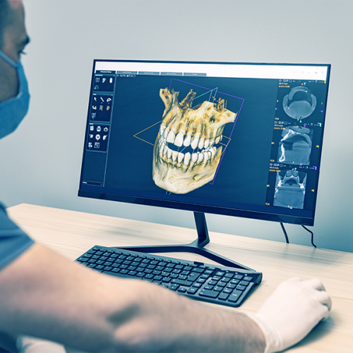 Check-up ortodontico bambini con una persona che indossa una maschera e dei guanti esamina una scansione dentale 3D dei denti e della struttura della mascella di un bambino, visualizzata sul monitor di un computer in un ambiente clinico.