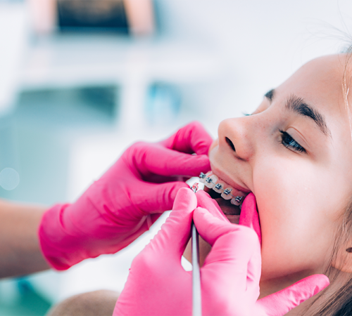 Paradenti bambini con una bambina durante una visita odontoiatrica mentre un professionista applica un dispositivo dentale con guanti rosa.