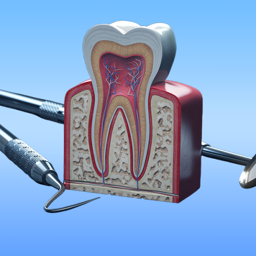 Ricostruzione dente rotto bambino rappresentata da un modellino tridimensionale di un dente sezionato che mostra smalto, dentina e polpa con vasi sanguigni interni, appoggiato su strumenti odontoiatrici metallici su sfondo azzurro.