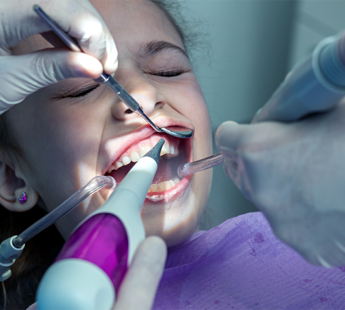 Ipomineralizzazione denti bambini rappresentata da una bambina durante un trattamento odontoiatrico, con gli occhi chiusi mentre più strumenti dentistici vengono utilizzati nella sua bocca da mani con guanti bianchi, in uno studio odontoiatrico illuminato.