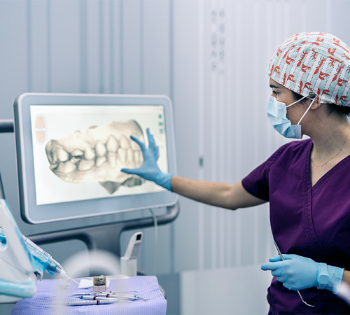 Byte per bruxismo illustra una professionista sanitaria che osserva la scansione digitale 3D di un’arcata dentale su un grande monitor in ambulatorio