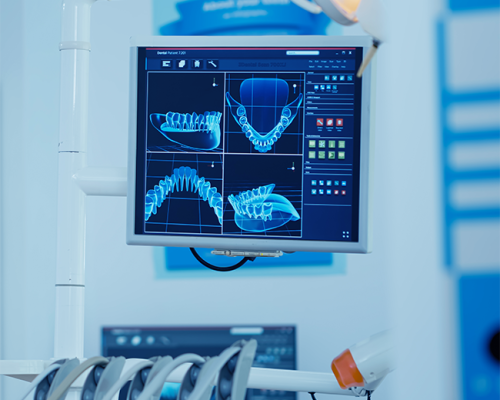 Protesi e chirurgia dentale mostra una radiografia digitale delle arcate dentarie su monitor odontoiatrico, utilizzata per la pianificazione di interventi protesici e chirurgici.