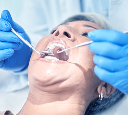 Chirurgia parodontale evidenzia una paziente adulta durante un intervento odontoiatrico mentre il dentista utilizza strumenti specifici per trattare i tessuti gengivali