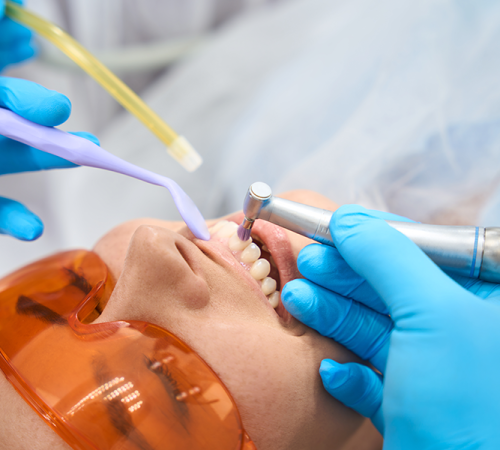 Chirurgia parodontale mostra una persona che indossa occhiali protettivi arancioni mentre riceve un trattamento odontoiatrico. Mani guantate utilizzano strumenti dentali e un tubo di aspirazione all'interno della bocca, concentrandosi sui denti.