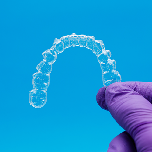 Cure dentali proposte da una mano con un guanto viola regge un allineatore dentale trasparente su uno sfondo blu.
