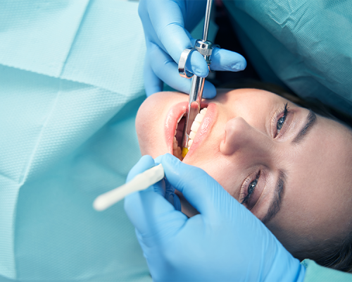 Otturazioni dentali mostra una paziente che riceve un trattamento conservativo con strumenti odontoiatrici, mentre il dentista prepara il dente per una ricostruzione precisa