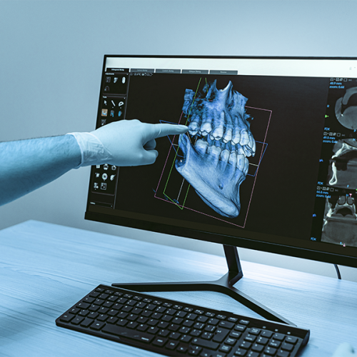 trattamenti odontoiatrici evidenzia un monitor con ricostruzione digitale 3D del cranio e dell’arcata dentale mentre una mano con guanto indica un punto specifico dell’immagine
