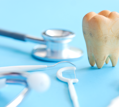Trauma dentale con evidenza di strumenti dentistici e un dente artificiale su sfondo azzurro