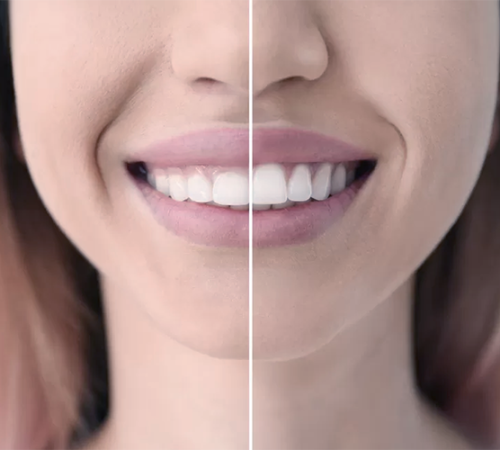 Dental200