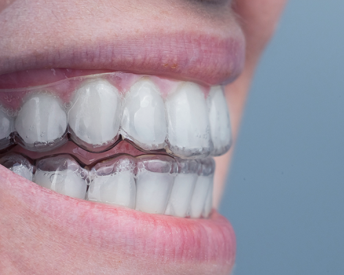 Dental243